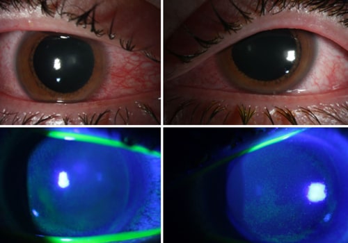 Is UV Light Smell Dangerous?